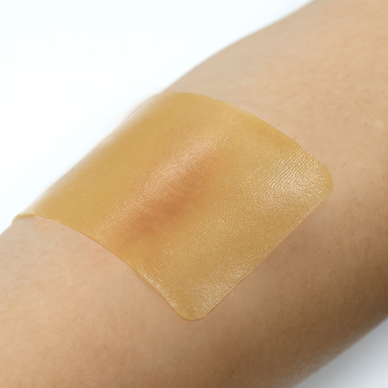 Silicone Scar Sheet-Reduces redness, relieves discomfort and itchy skin