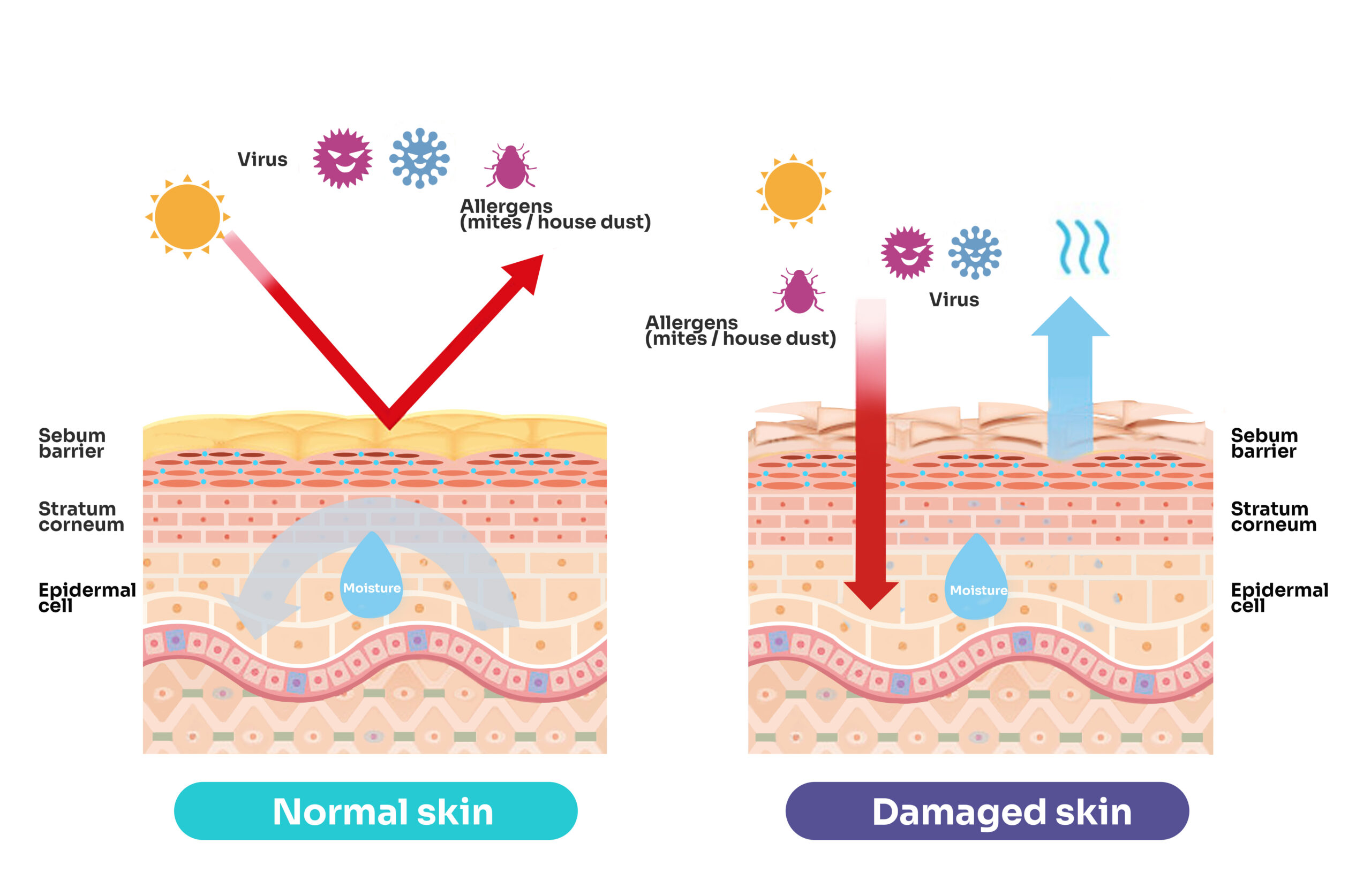 Moist Wound Healing vs. Dry Wound Healing