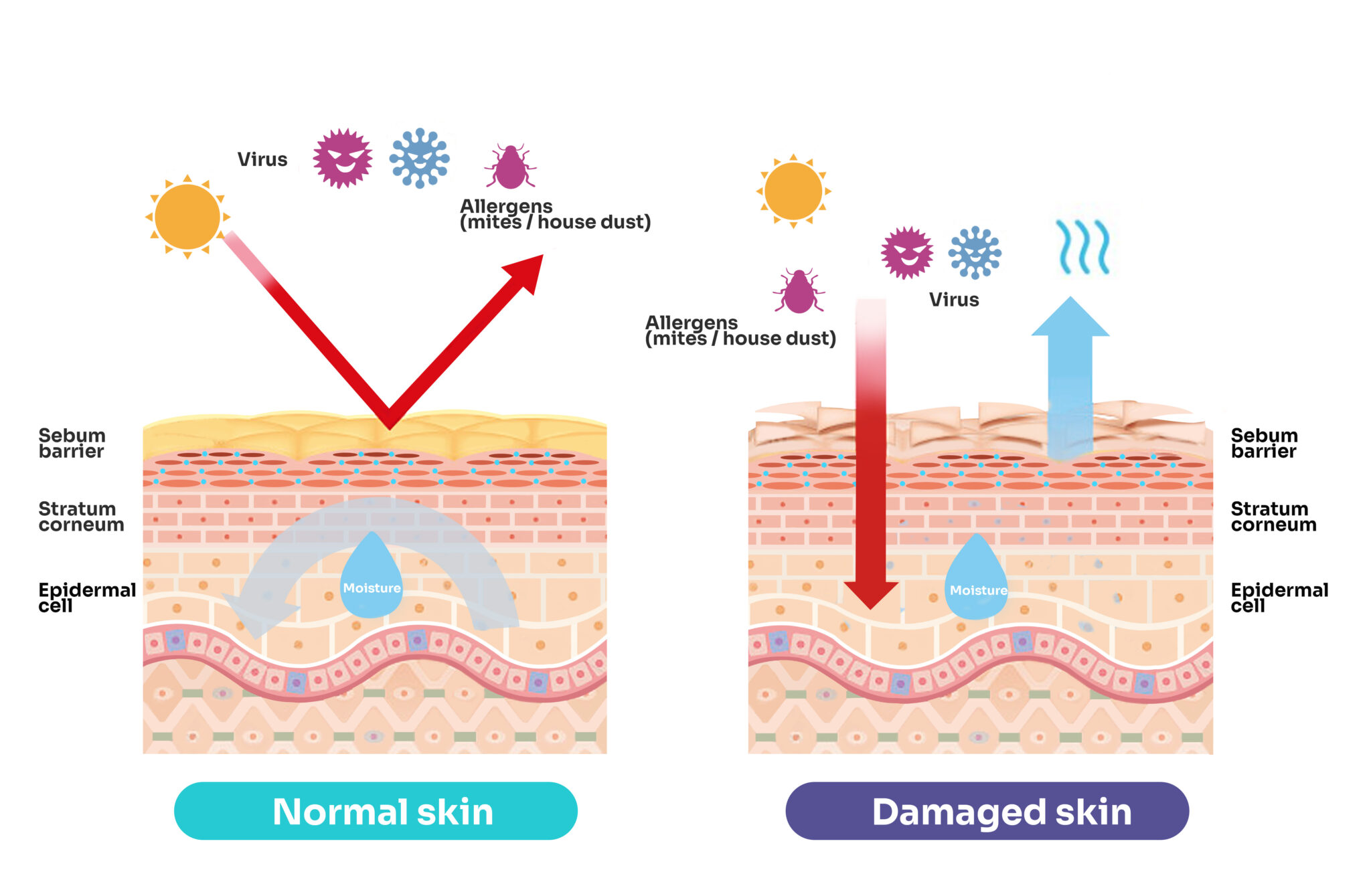 Moist Wound Healing vs. Dry Wound Healing - Conkote- Medical supply experts