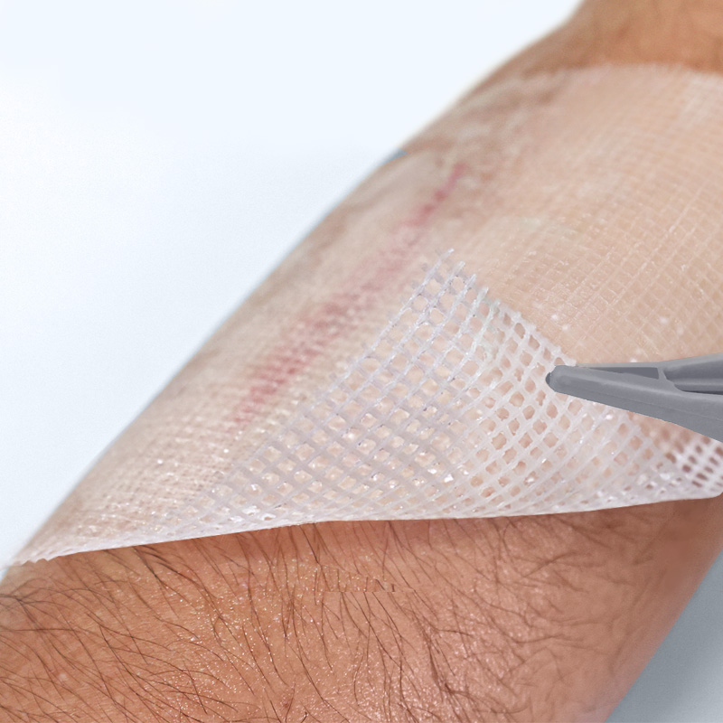 Vaseline Gauze being lifted from skin easily without sticking to the wound