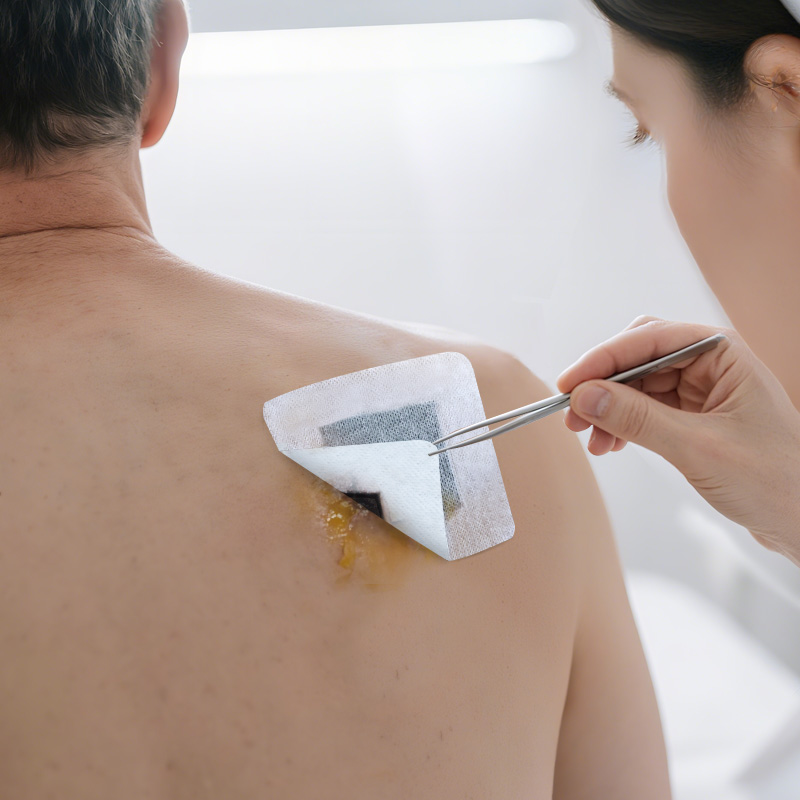 Charcoal wound dressing absorbing and eliminating unpleasant wound odors