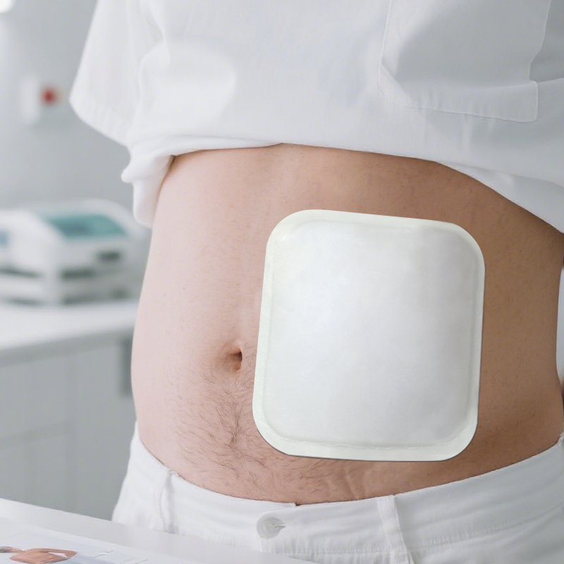 Hydrocolloid adhesive layer provides gentle, secure fixation for sensitive skin
