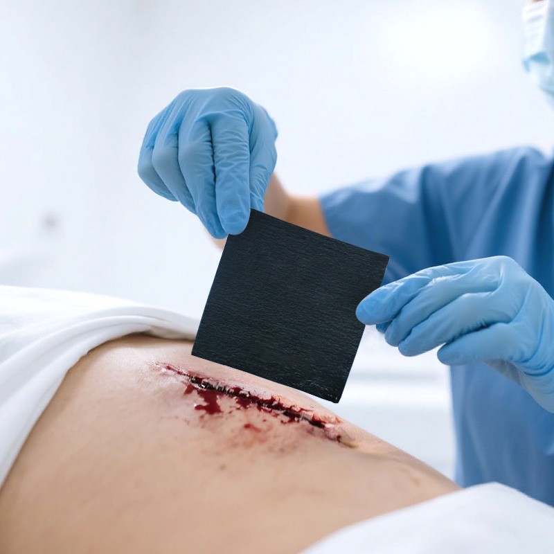 Hydrogel dressing being applied easily to a wound without adhesive