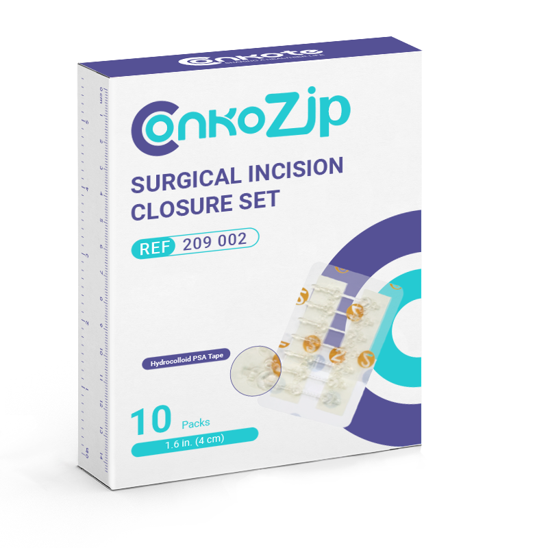 Surgical Incision Closure Set packaging featuring fast and efficient wound closure, trauma-minimizing skin stapler, and user-friendly design
