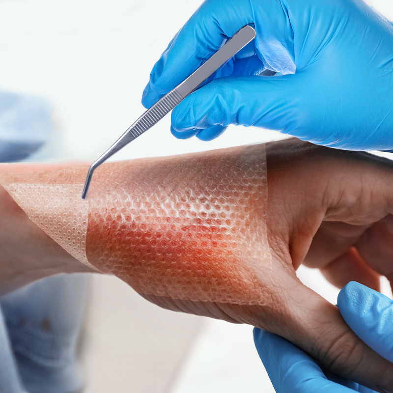 Silicone contact layer being lifted off easily without sticking to new tissue