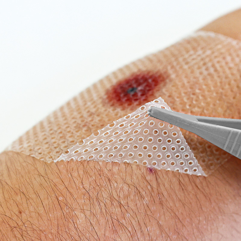 Flexible silicone mesh bending and conforming to body curves