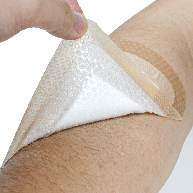 Silicone adhesive border of the SAP dressing securing to skin without irritation