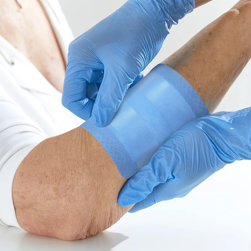 Blue SAP dressing being gently lifted from skin without sticking