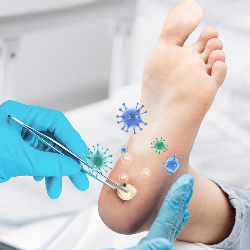 Antimicrobial Silver Ions Help Prevent Wound Infection