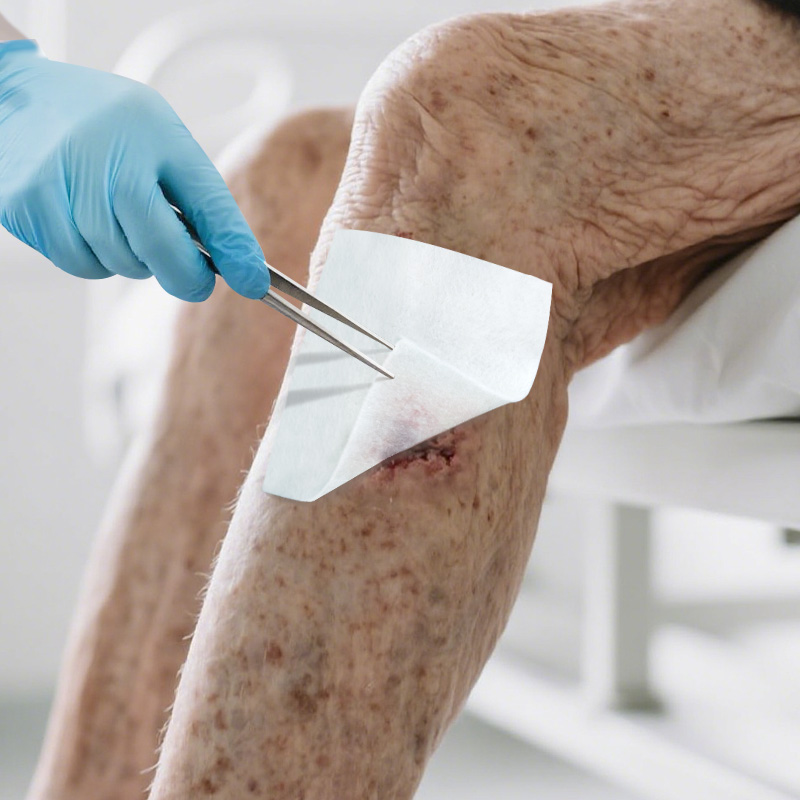 Hydrophilic fibers absorb high volumes of wound exudate