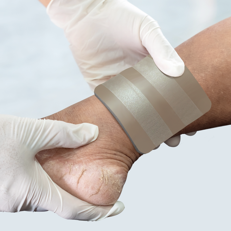 Soft and flexible Silver Foam Dressing conforming to wound contours without adhesive