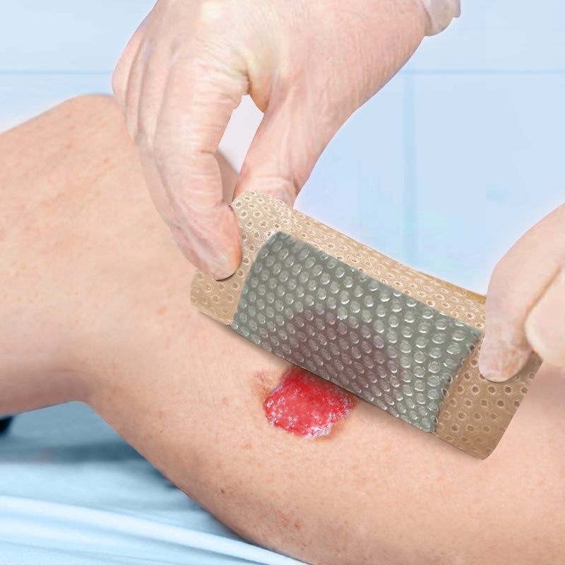 Silver ion foam dressing offering powerful antimicrobial protection for infected and high-risk wounds