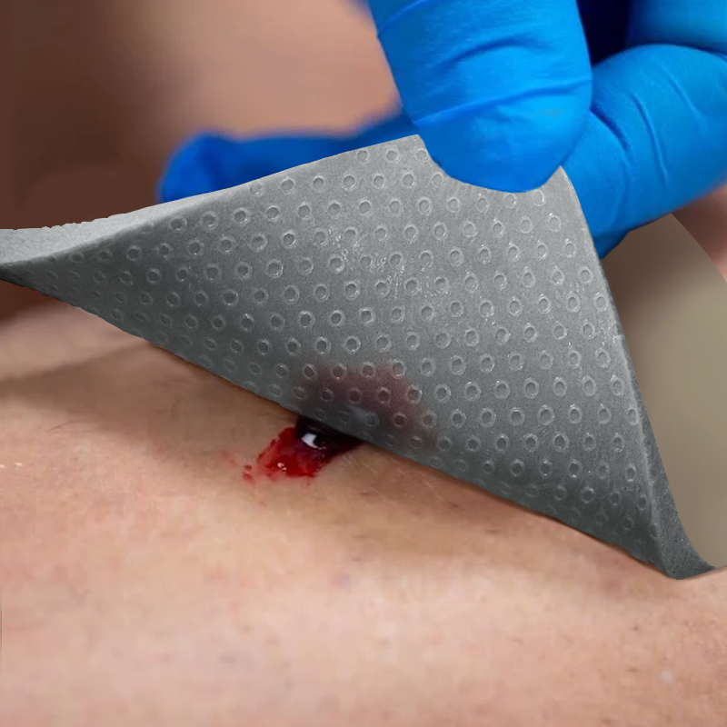 Antimicrobial silver ion foam dressing protecting wounds from infection and accelerating healing