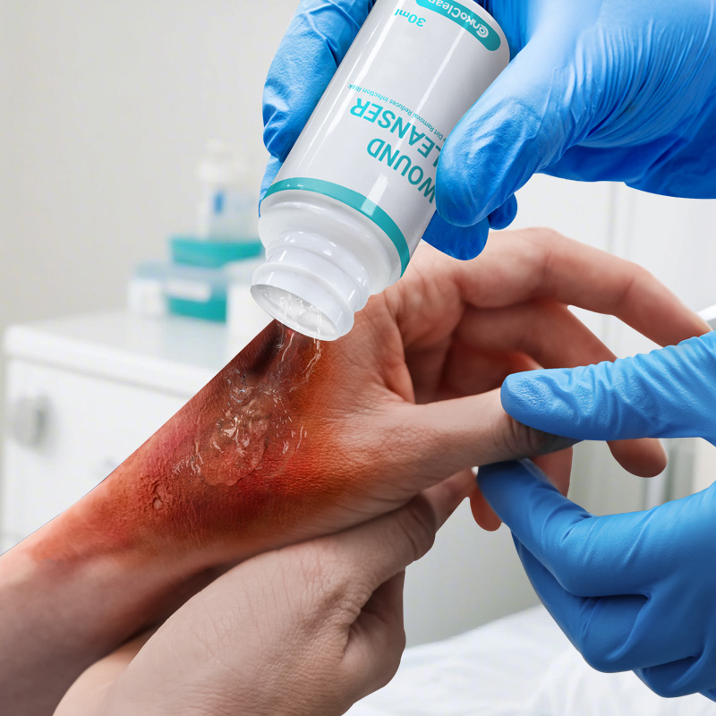 Wound Cleanser being sprayed on a wound, with arrows showing removal of debris and bacteria