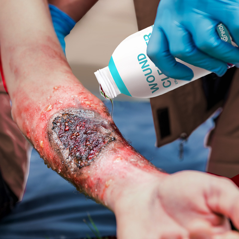 Close-up of Wound Cleanser on sensitive skin area, showing no redness or irritation