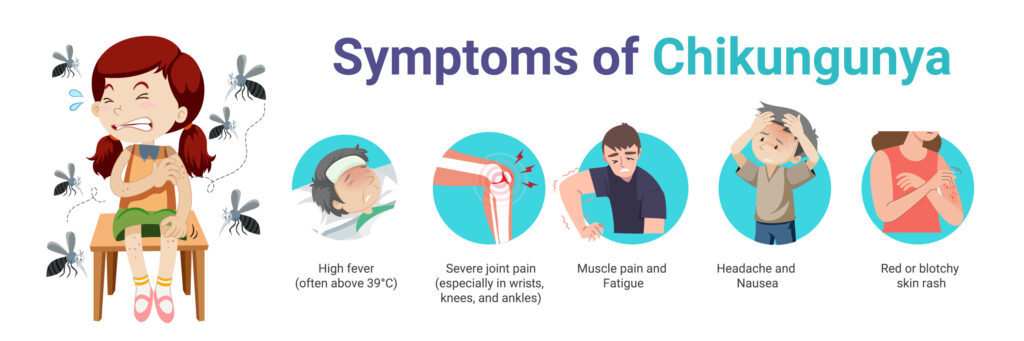 Key symptoms of Chikungunya including fever, rash, and joint pain