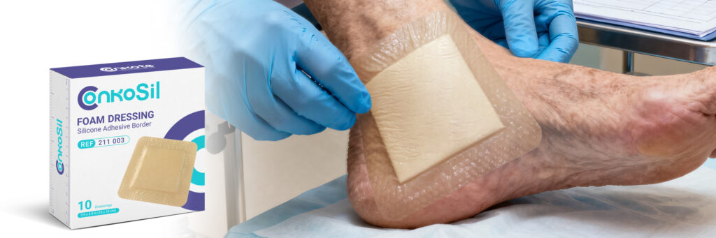 ConkoSil – Soft Silicone Foam Dressing for Gentle and Effective Wound Care