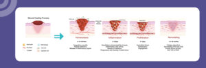 The 4 Stages of Wound Healing Explained | A Complete Guide