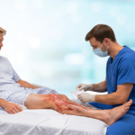 Burn wound assessment showing different levels of skin damage and healing complexity