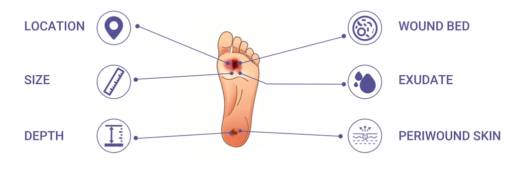 Illustration of a diabetic foot ulcer showing six wound assessment factors including location, size, depth, wound bed, exudate, and periwound skin