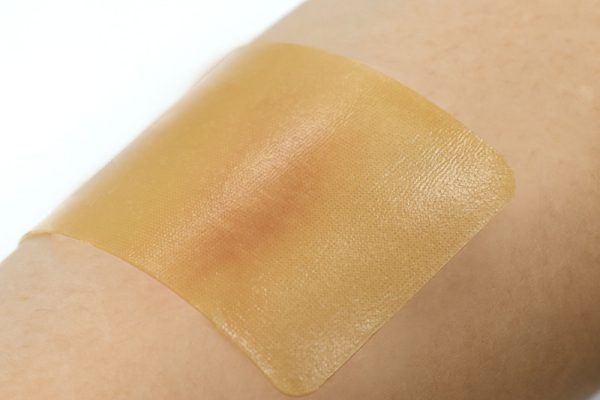 Silicone Scar Sheet-Reduces redness, relieves discomfort and itchy skin